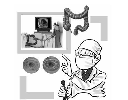 炎性肠病.jpg 炎性肠病.jpg