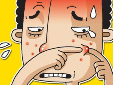 痤疮科普3.jpg 痤疮科普3.jpg