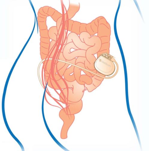 微信图片_20190425165214.png 微信图片_20190425165214.png